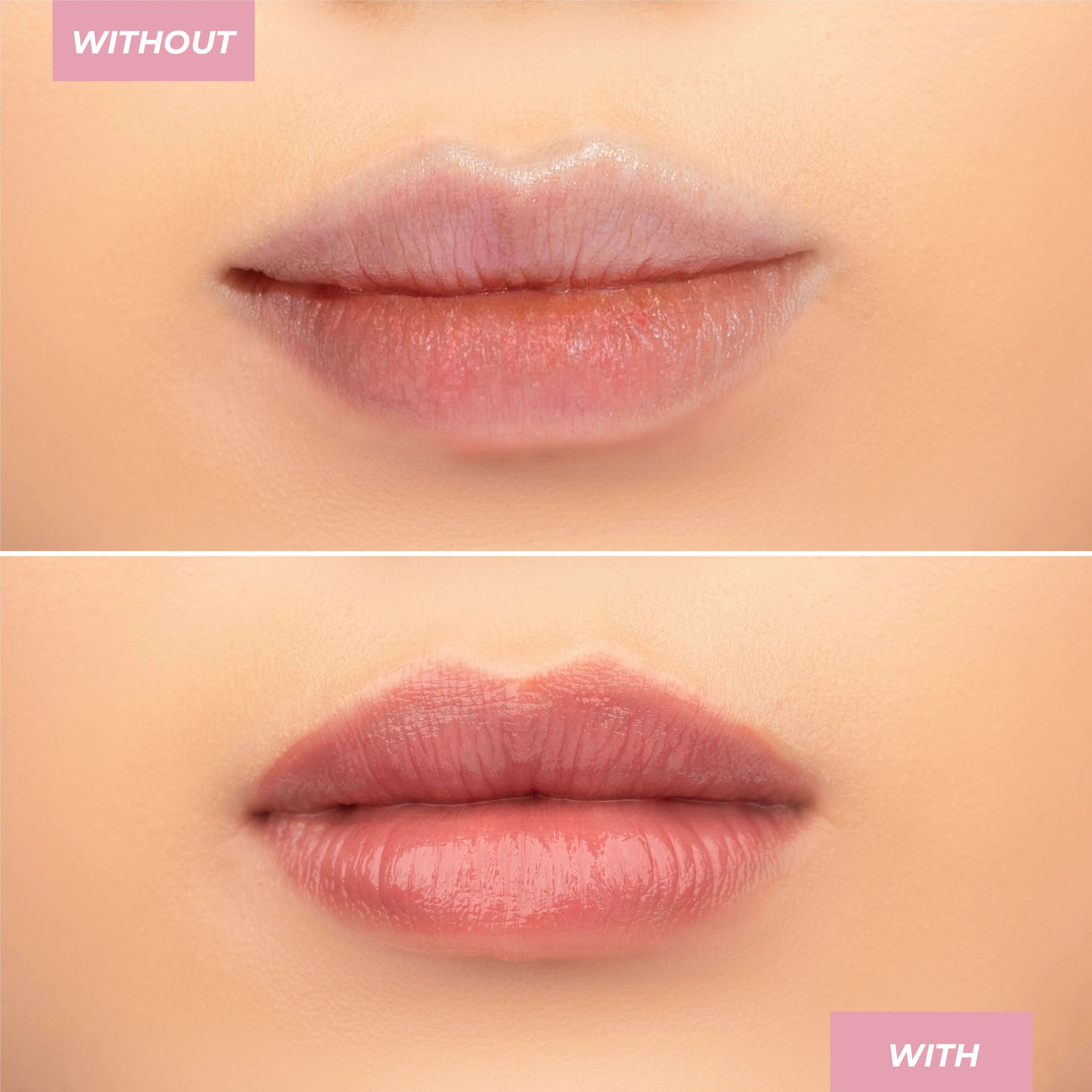 Hyaluronic Lip Balm