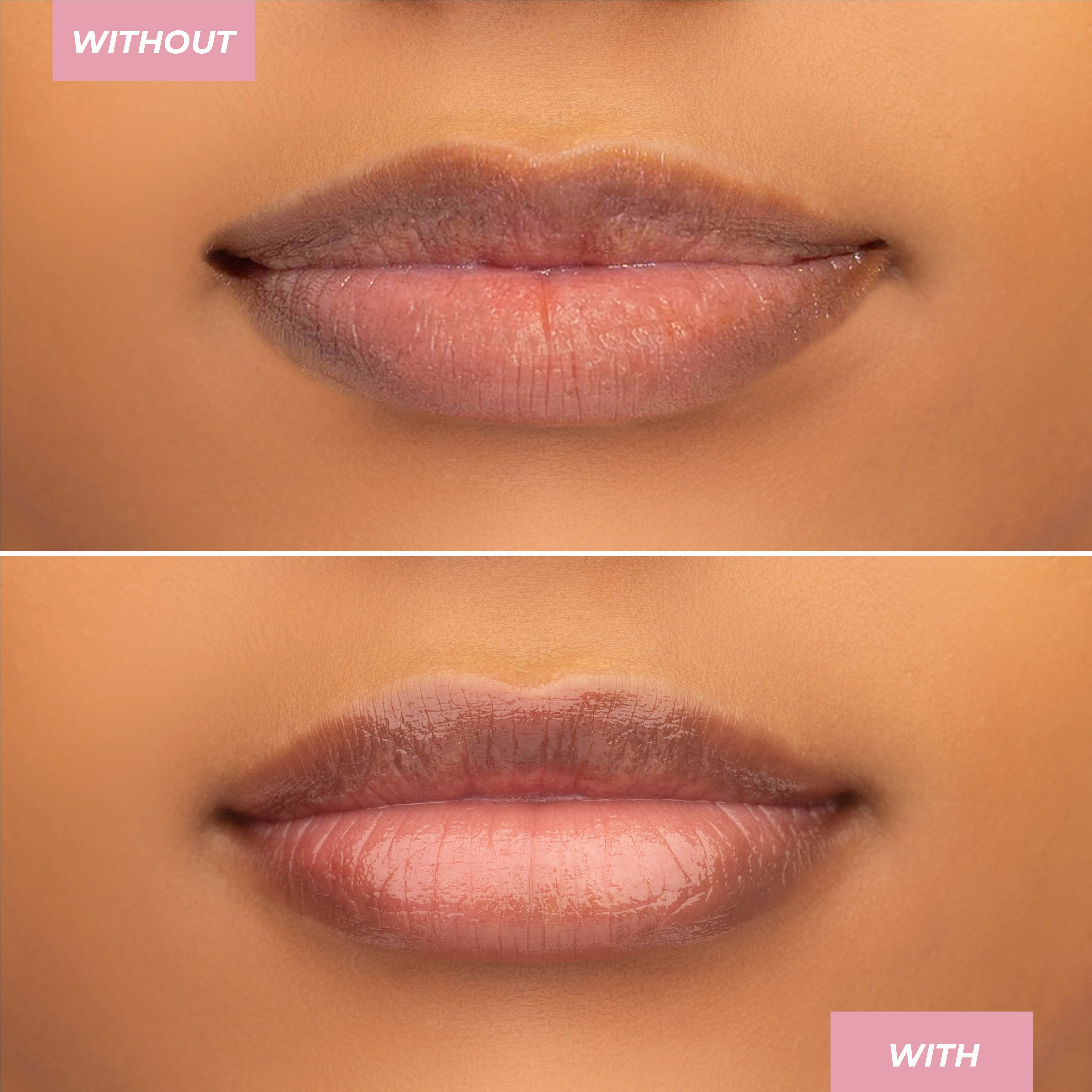 Hyaluronic Lip Balm